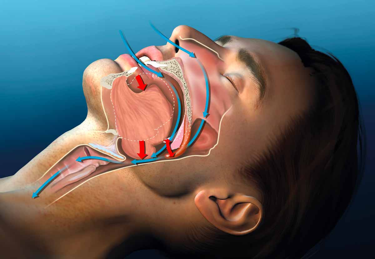 Russamento terapia laser milano Dott.ssa Melissa Roso
